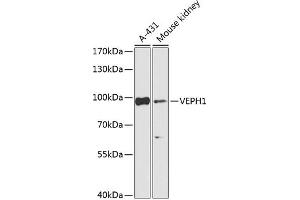 Western blot analysis of extracts of various cell lines, using VEPH1 Antibody (ABIN7271308) at 1:1000 dilution. (VEPH1 抗体  (AA 448-547))