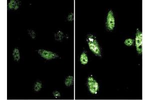 Immunofluorescence (IF) image for anti-Signal Transducer and Activator of Transcription 6, Interleukin-4 Induced (STAT6) (pTyr641) antibody (ABIN968594) (STAT6 抗体  (pTyr641))
