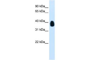 WB Suggested Anti-ETV7 Antibody Titration:  0. (ETV7 抗体  (C-Term))
