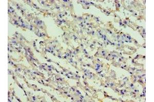 Immunohistochemistry of paraffin-embedded human lung tissue using ABIN7167479 at dilution of 1:100 (RIPK3 抗体  (AA 1-120))