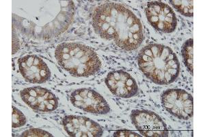 Immunoperoxidase of monoclonal antibody to MT on formalin-fixed paraffin-embedded human colon. (MCAT 抗体  (AA 291-390))