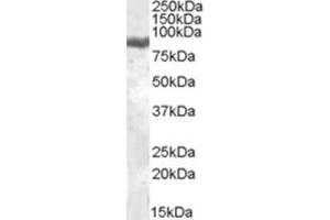 Image no. 1 for anti-Lactotransferrin (LTF) (Internal Region) antibody (ABIN375038) (Lactoferrin 抗体  (Internal Region))