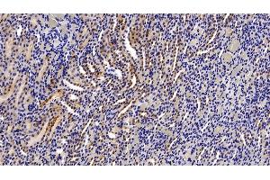 Detection of ASS1 in Rat Kidney Tissue using Polyclonal Antibody to Argininosuccinate Synthetase 1 (ASS1) (ASS1 抗体  (AA 1-412))