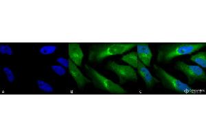 Immunocytochemistry/Immunofluorescence analysis using Rabbit Anti-BVR Polyclonal Antibody . (Biliverdin Reductase 抗体  (HRP))