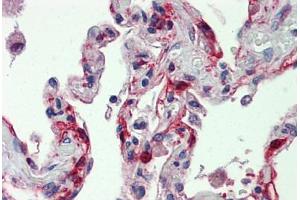 Human Lung: Formalin-Fixed, Paraffin-Embedded (FFPE) (Factor VII 抗体  (AA 209-444))