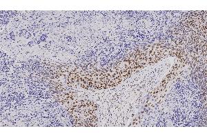 Immunohistochemistry (IHC) image for anti-Mismatch Repair Protein 2 (MSH2) antibody (ABIN7538912)