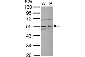 Western Blotting (WB) image for anti-Ribosomal RNA Processing 1 Homolog A (RRP1) (Internal Region) antibody (ABIN1496142) (RRP1 抗体  (Internal Region))
