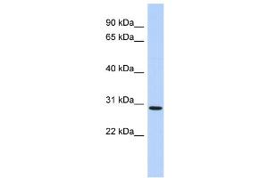 WB Suggested Anti-SERTAD2 Antibody Titration:  0.