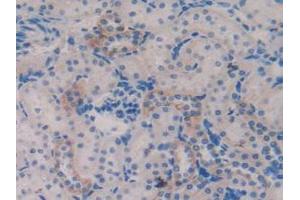 Detection of TFF3 in Rat Kidney Tissue using Polyclonal Antibody to Trefoil Factor 3 (TFF3) (TFF3 抗体  (AA 23-81))