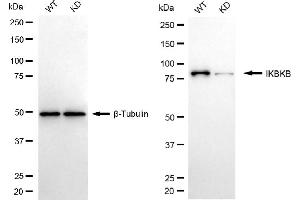 Western blotting analysis using IKBKB antibody (ABIN7799034).