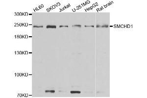 Western blot analysis of extracts of various cell lines, using SMCHD1 antibody. (SMCHD1 抗体)