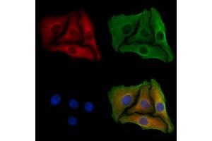 ABIN6258178 and ABIN6273873 staining Hela cells by IF/ICC. (GPR39 抗体  (C-Term))
