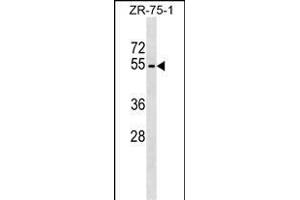 PLD4 Antibody (N-term) (ABIN1539414 and ABIN2849223) western blot analysis in ZR-75-1 cell line lysates (35 μg/lane). (Phospholipase D4 抗体  (N-Term))