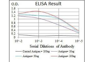 Black line: Control Antigen (100 ng), Purple line: Antigen(10 ng), Blue line: Antigen (50 ng), Red line: Antigen (100 ng), (MAP2 抗体  (AA 24-123))