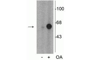 Western blot of PC-12 cell lysate incubated in the absence (-) and presence (+) of okadaic acid (OA, 1 µM for 60 min)  showing specific immunolabeling of the ~60 kDa tyrosine hydroxylase phosphorylated at Ser31. (Tyrosine Hydroxylase 抗体  (pSer31))