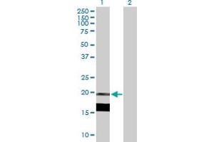 Western Blot analysis of IL7 expression in transfected 293T cell line by IL7 MaxPab polyclonal antibody. (IL-7 抗体  (AA 1-177))