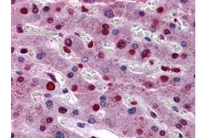 Immunohistochemistry (IHC) image for anti-Signal Transducer and Activator of Transcription 3 (Acute-Phase Response Factor) (STAT3) antibody (ABIN969420)
