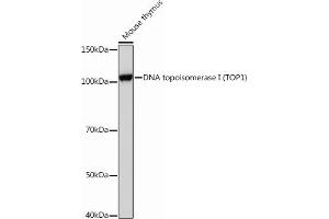 Western blot analysis of extracts of Mouse thymus, using DNA topoisomerase I (DNA topoisomerase I (TOP1)) Rabbit mAb (ABIN7270850) at 1:1000 dilution. (Topoisomerase I 抗体)