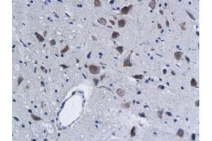 Formalin-fixed and paraffin embedded rat brain labeled with Anti-Phospho-Lyn (Tyr396) Polyclonal Antibody, Unconjugated (ABIN743618) followed by conjugation to the secondary antibody and DAB staining (LYN 抗体  (pTyr397))