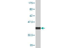 Western Blot detection against Immunogen (36. (CDKN1B 抗体  (AA 100-198))