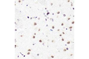 Immunohistochemistry (Paraffin-embedded Sections) (IHC (p)) image for anti-Histone 3 (H3) (H3R2me2) antibody (ABIN3017480)