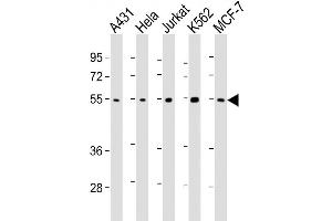 Lane 1: A431, Lane 2: HeLa, Lane 3: Jurkat, Lane 4: K562, Lane 5: MCF-7 cell lysates at 20ug per lane, probed with bsm-51266M CHK1 (2G1D5) Monoclonal Antibody at 1:1000 overnight at 4°C followed by a conjugated secondary antibody for 60 minutes at 37°C. (CHEK1 抗体)
