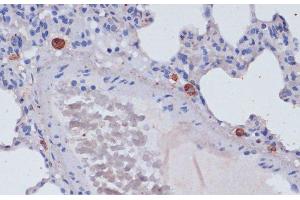 Immunohistochemistry of paraffin-embedded Rat lung using Perforin Polyclonal Antibody at dilution of 1:100 (40x lens). (Perforin 1 抗体)