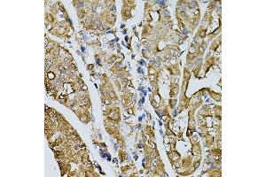 Immunohistochemistry of paraffin-embedded human stomach using MYL1 antibody. (MYL1 抗体  (AA 1-150))