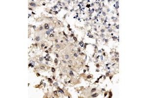 IHC analysis of MNT using anti-MNT antibody (ABIN7601555). (MNT 抗体  (AA 381-564))