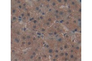IHC-P analysis of Human Tissue, with DAB staining. (REV1 抗体  (AA 301-478))
