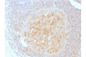 Immunohistochemistry (IHC) image for anti-CD40 (CD40) antibody (ABIN6941185)