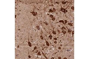 Immunohistochemical staining of human hippocampus with KARS polyclonal antibody  shows strong cytoplasmic positivity in neuronal cells at 1:500-1:1000 dilution. (KARS 抗体)