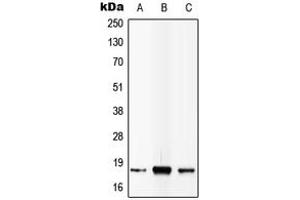 Western blot analysis of IL-4 expression in MCF7 (A), SP2/0 (B), PC12 (C) whole cell lysates. (IL-4 抗体  (C-Term))