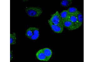 MCF-7 cells were stained with Cytokeratin 4 (2F9) Monoclonal Antibody  at [1:200] incubated overnight at 4C, followed by secondary antibody incubation, DAPI staining of the nuclei and detection. (KRT4 抗体)