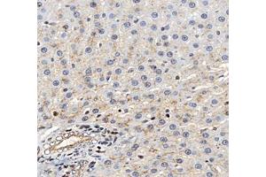 Immunohistochemistry (Paraffin-embedded Sections) (IHC (p)) image for anti-Mal, T Cell Differentiation Protein 2 (MAL2) antibody (ABIN7074549)