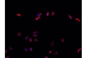 ABIN6266561 staining U-2 OS cells by IF/ICC. (HDAC9 抗体  (C-Term))