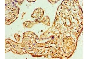 Immunohistochemistry of paraffin-embedded human placenta tissue using ABIN7144666 at dilution of 1:100 (AIPL1 抗体  (AA 1-384))