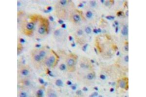 IHC-P analysis of Liver tissue, with DAB staining. (CD97 抗体  (AA 32-173))