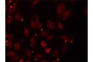 Immunofluorescence (IF) image for anti-Propionyl CoA Carboxylase beta Polypeptide (PCCB) antibody (ABIN1876603) (PCCB 抗体)