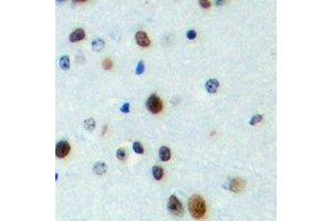 Immunohistochemical analysis of FOXN4 staining in human brain formalin fixed paraffin embedded tissue section. (FOXN4 抗体  (C-Term))