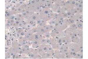 IHC-P analysis of Mouse Liver Tissue, with DAB staining. (Cortactin 抗体  (AA 1-509))