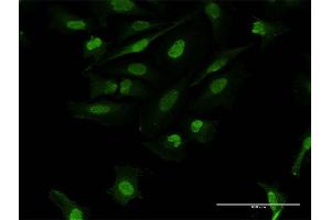 Immunofluorescence of purified MaxPab antibody to FOSL2 on HeLa cell.