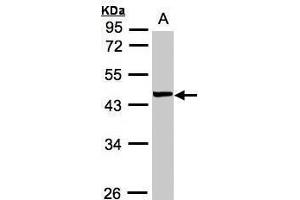 WB Image Sample(30 ug whole cell lysate) A:MOLT4 , 10% SDS PAGE antibody diluted at 1:1000 (VPS72 抗体)
