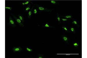 Immunofluorescence of monoclonal antibody to GAN on HeLa cell. (GAN 抗体  (AA 534-597))