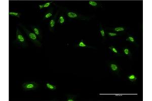 Immunofluorescence of monoclonal antibody to GAN on HeLa cell. (GAN 抗体  (AA 534-597))