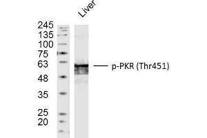 Mouse liver lysates probed with PKR(Thr451) Polyclonal Antibody, unconjugated  at 1:300 overnight at 4°C followed by a conjugated secondary antibody at 1:10000 for 90 minutes at 37°C.