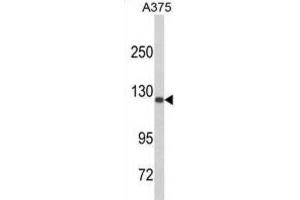 Western Blotting (WB) image for anti-Desmocollin 1 (DSC1) antibody (ABIN3003859) (Desmocollin 1 抗体)