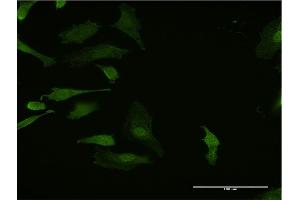 Immunofluorescence of monoclonal antibody to HHEX on HeLa cell. (HHEX 抗体  (AA 133-237))