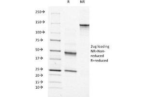 SDS-PAGE Analysis of Purified, BSA-Free Moesin Antibody (clone MSN/491). (Moesin 抗体)