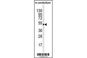 Western blot analysis of BTBD1 antibody in mouse cerebellum tissue lysates (35ug/lane) (BTBD1 抗体  (AA 295-322))
